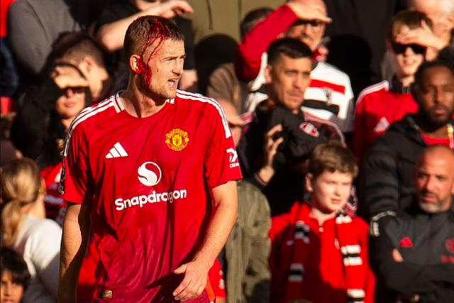 英雄联盟直播-林良锋：为曼联逆转和弗爵断粮叫好？这什么世道？